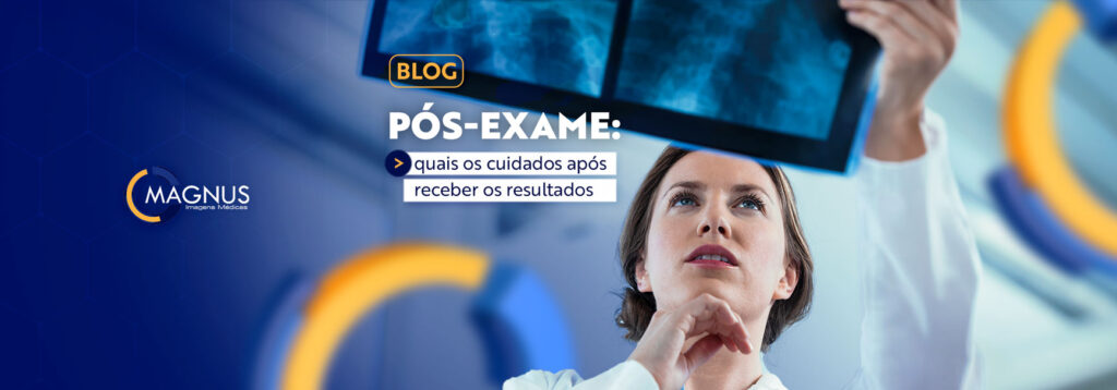 Pós-exame: quais os cuidados após receber o resultado?